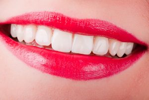 ein lachender Mund mit roten Lippen und weißem Zähnen